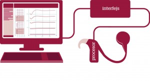 Za pomocą komputera połączonego przez interfejs z procesorem inżynier kliniczny programuje pamięć procesora w taki sposób, aby przetwarzał on dźwięki ze świata zewnętrznego na impulsy elektryczne w sposób optymalny dla pacjenta.